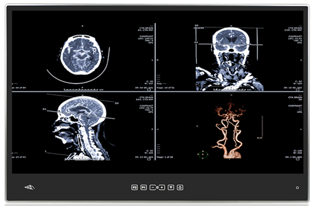 Displays médicos Macnica DHW têm tecnologia de ponta para equipamentos críticos de saúde